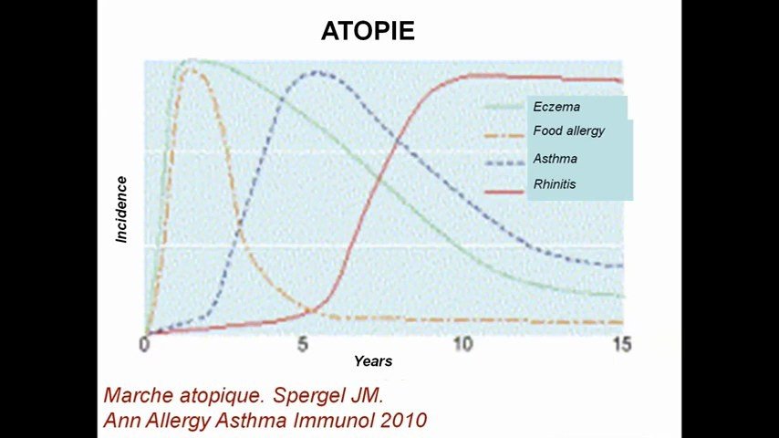 La marche atopique : évolution de l'incidence eczéma, allergie alimentaire, asthme, rhinite selon l'âge