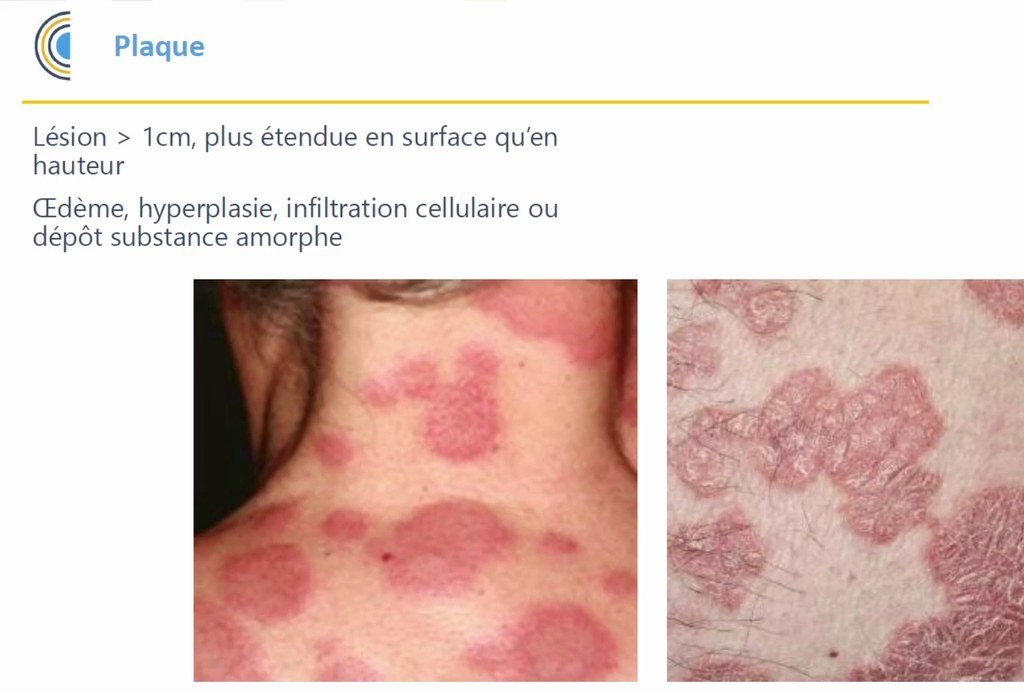 Sémiologie Dermatologique