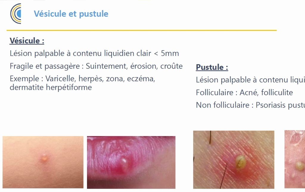 Sémiologie Dermatologique