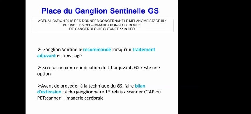 Place du ganglion sentinelle dans la prise en charge du mélanome