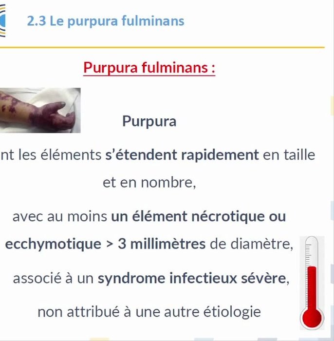 Purpura nécrotique extensif de l'avant-bras