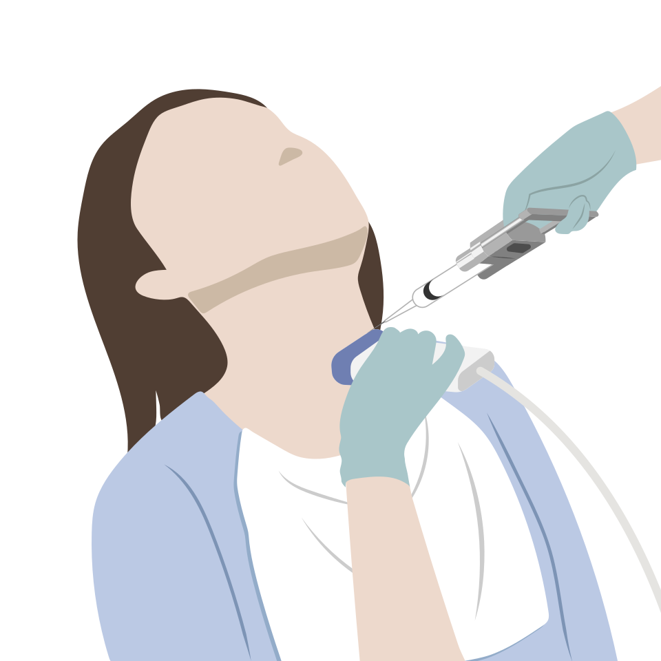 Cytoponction thyroïdienne