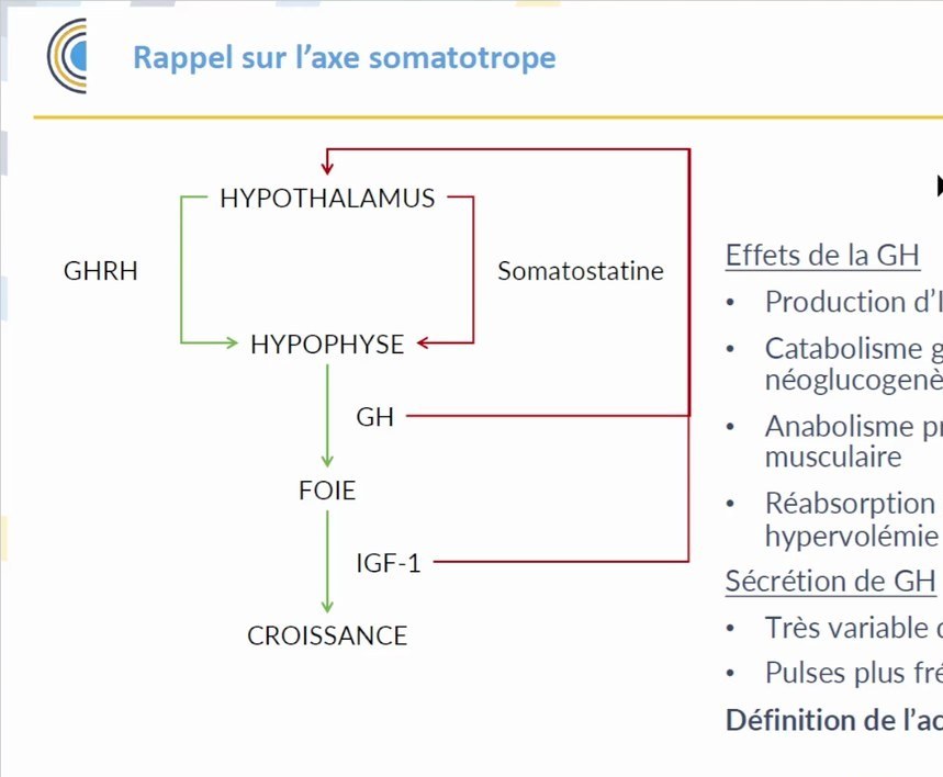 Acromégalie
