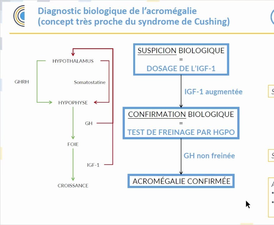 Acromégalie
