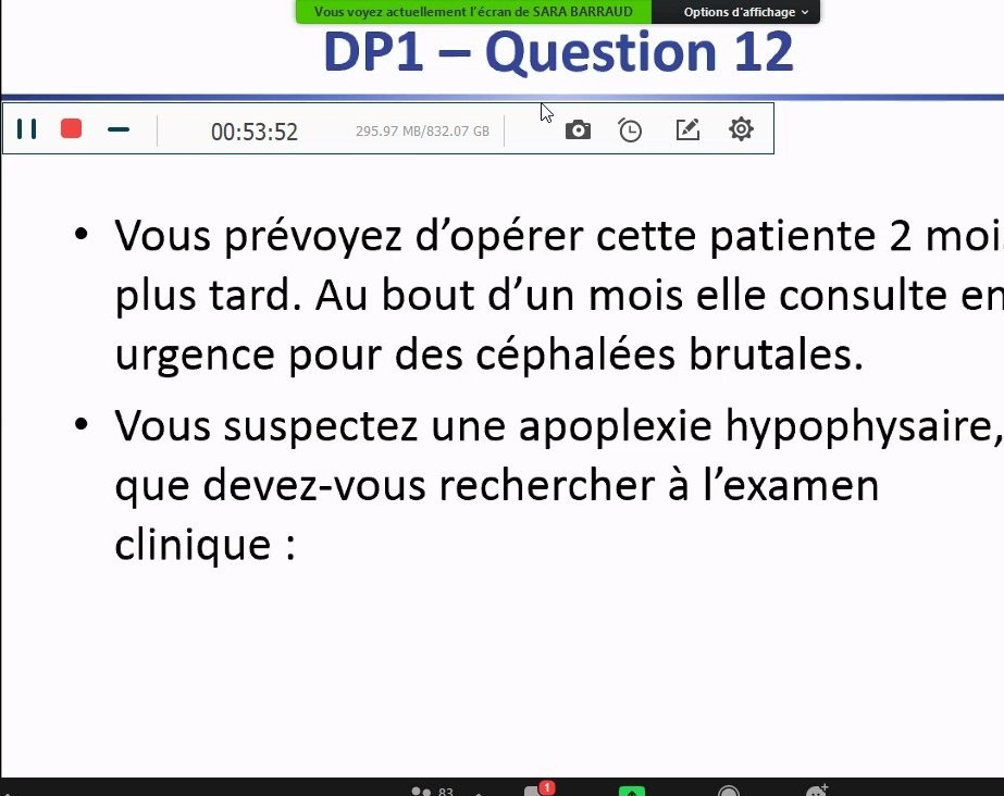 Aménorrhée