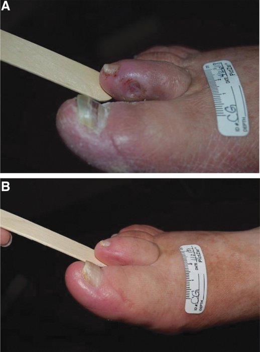 Une conjonction de facteurs neurologiques, vasculaires et infectieux