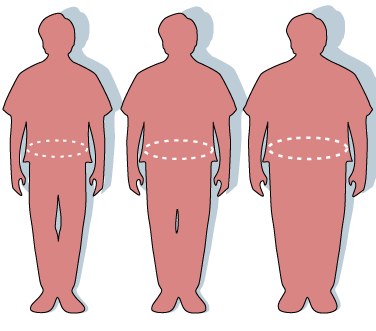 Répartition androïde de la graisse abdominale