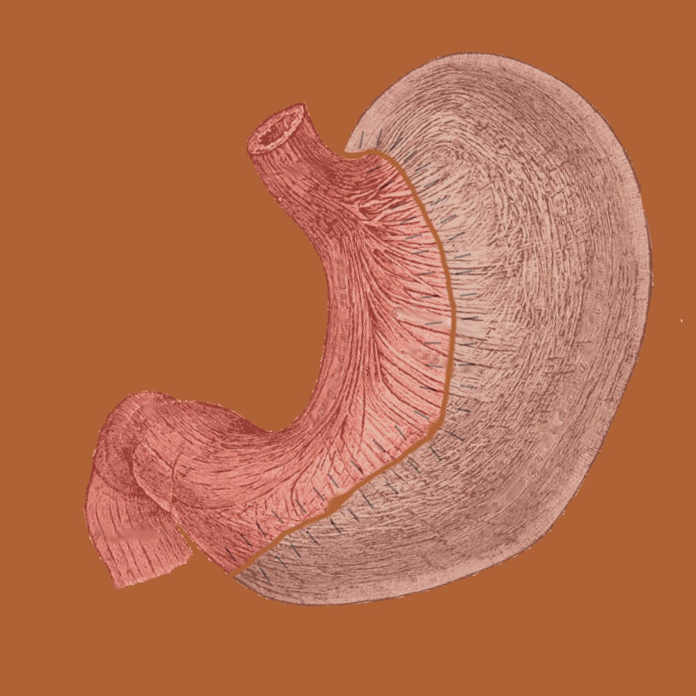 Sleeve gastrectomie (gastrectomie longitudinale)