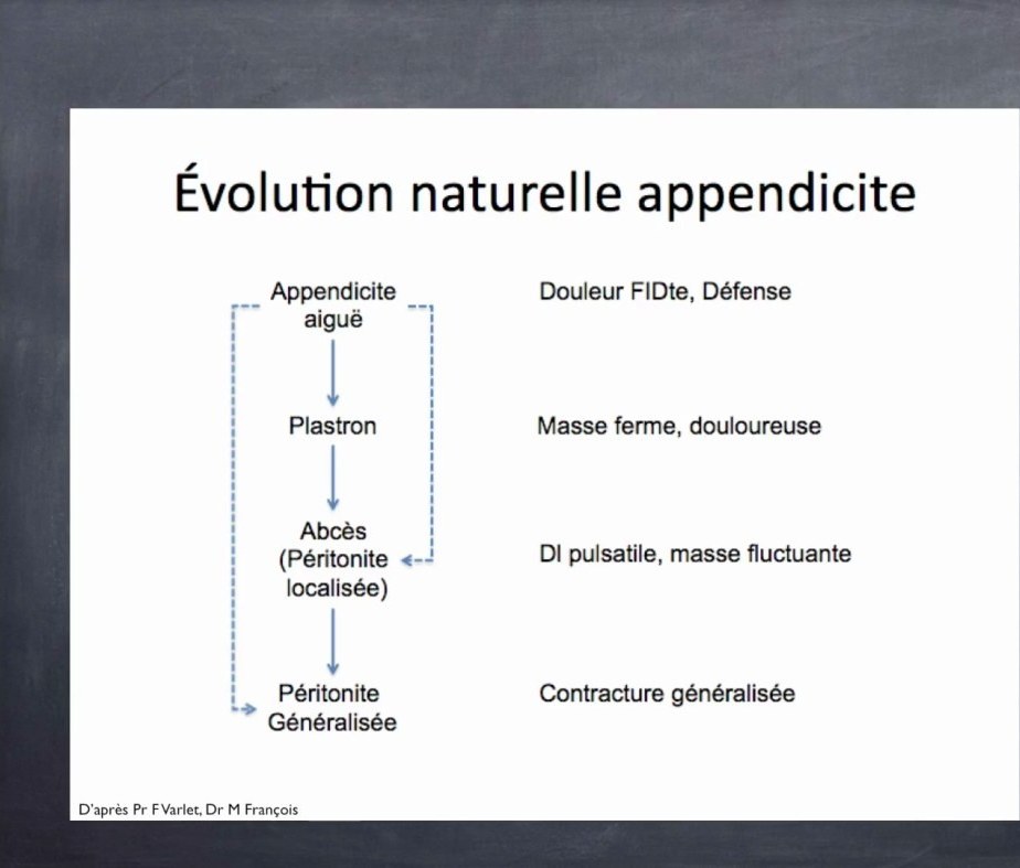Appendicite de l'Enfant et de l'Adulte