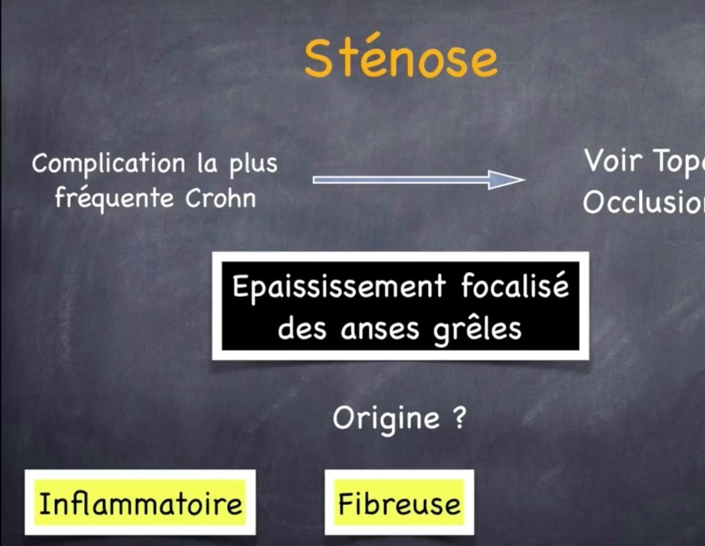 Colopathie Fonctionnelle et Syndrome de l'Intestin Irritable