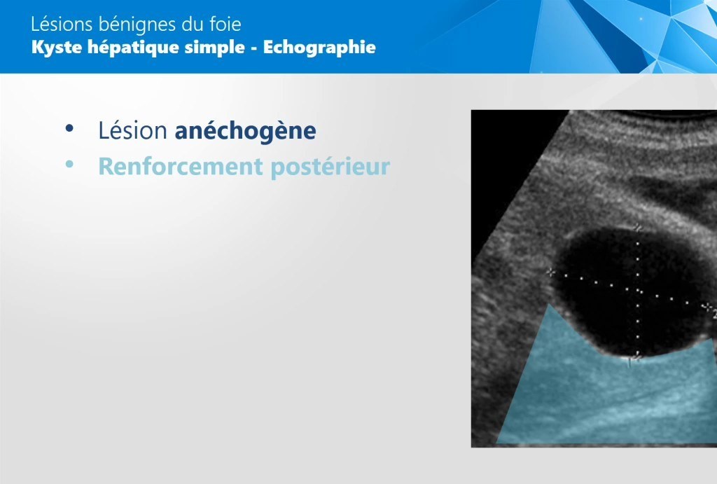 Hépatomégalie et Masse Abdominale