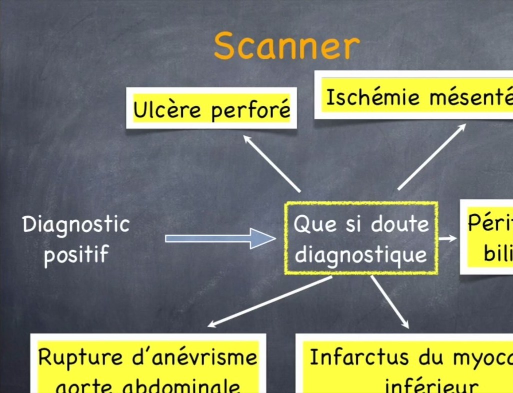 Pancréatite Aiguë