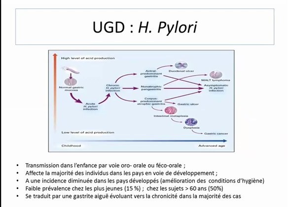 Ulcère Gastrique et Duodénal