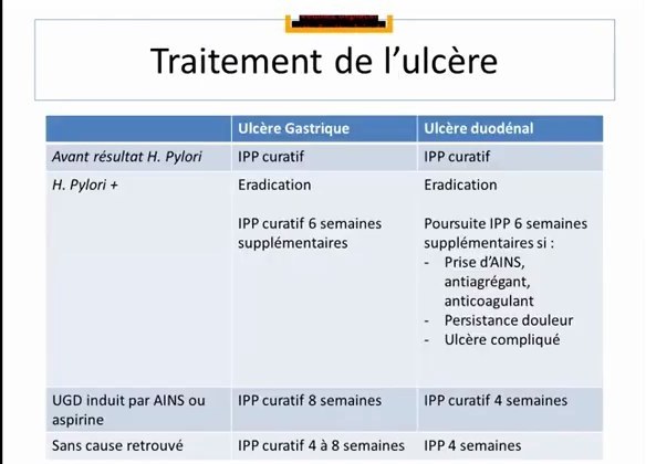Ulcère Gastrique et Duodénal