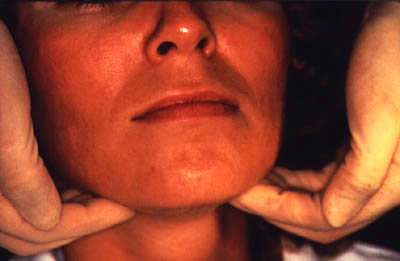 Palpation des adénopathies