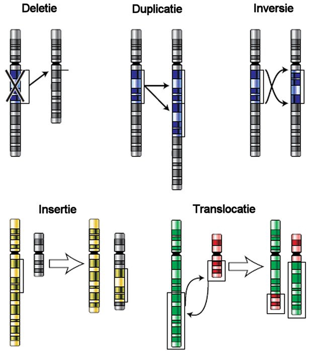 Anomalies chromosomiques structurant le pronostic des SMD