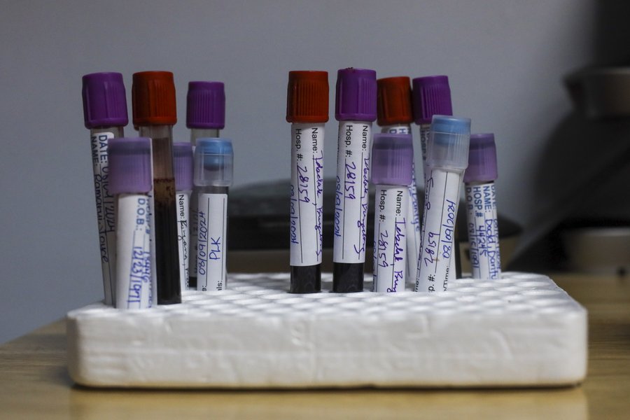 Normes biologiques spécifiques à l'âge