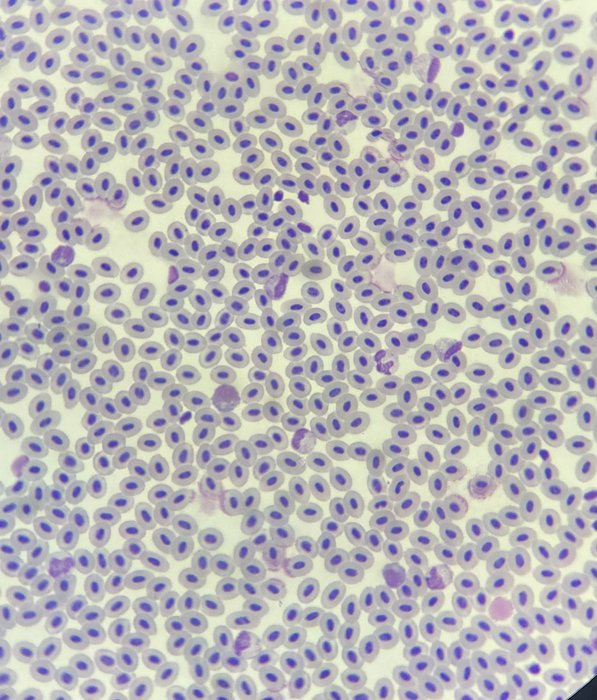 Frottis sanguin au microscope
