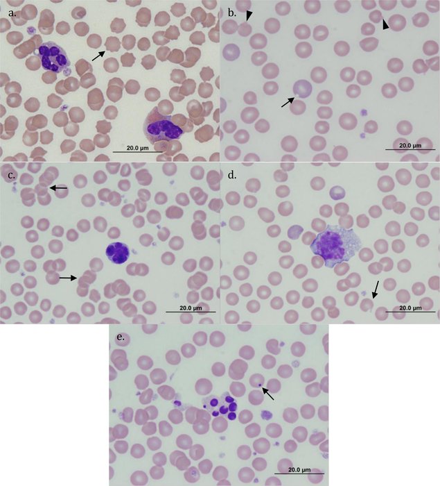 Globules rouges au microscope