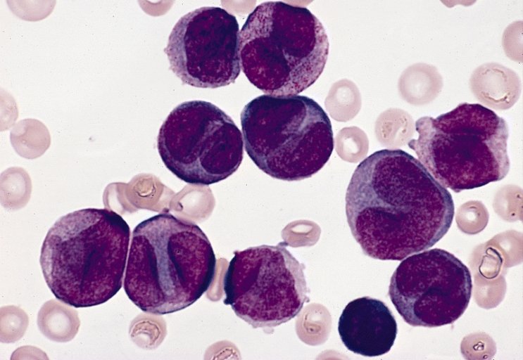 Différentes lignées de globules blancs