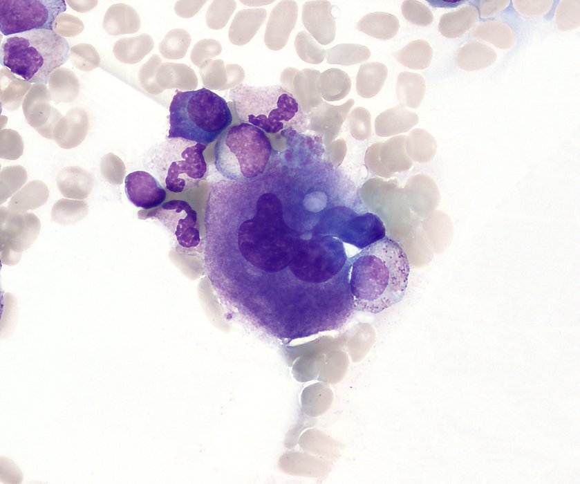 Mégacaryocyte médullaire