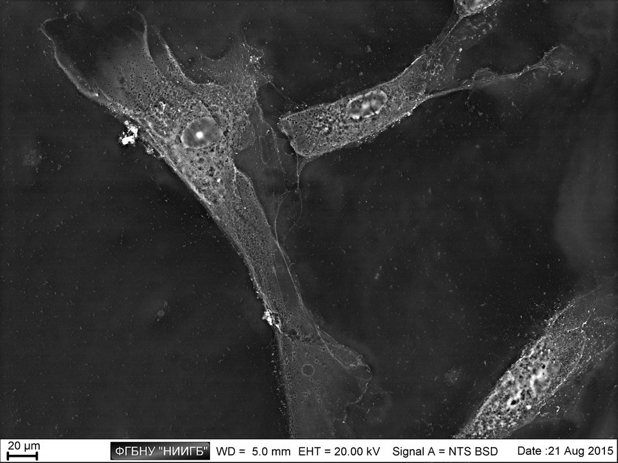 Cellules T génétiquement modifiées