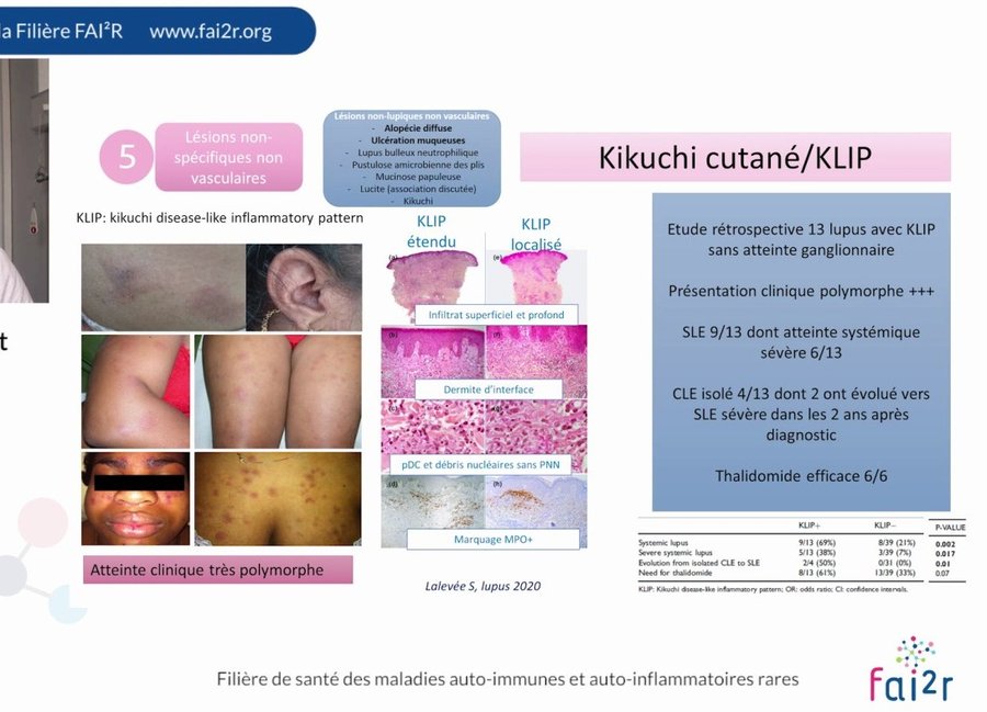 Lésions cutanées polymorphes du KLIP (Kikuchi disease-like inflammatory pattern) chez plusieurs patients, avec histologie