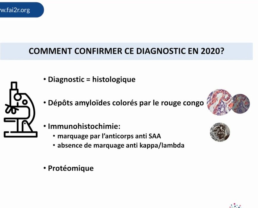 Dépôts amyloïdes colorés par le rouge Congo à l'examen histologique