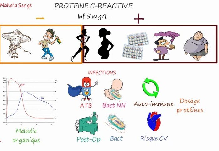 Facteurs diminuant et augmentant la CRP, cinétique CRP/VSH et principales causes d'élévation