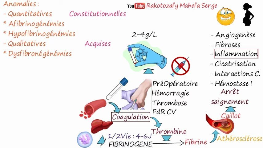 Le fibrinogène : synthèse hépatique, rôle dans la coagulation et anomalies constitutionnelles/acquises
