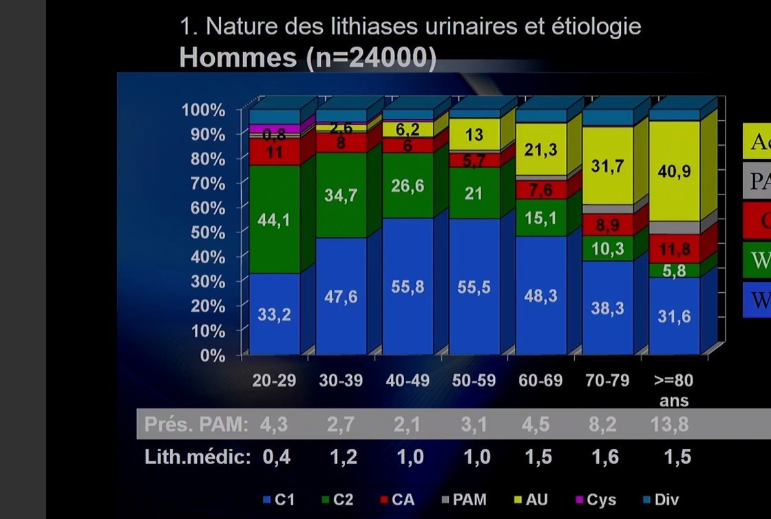 Lithiase Urinaire