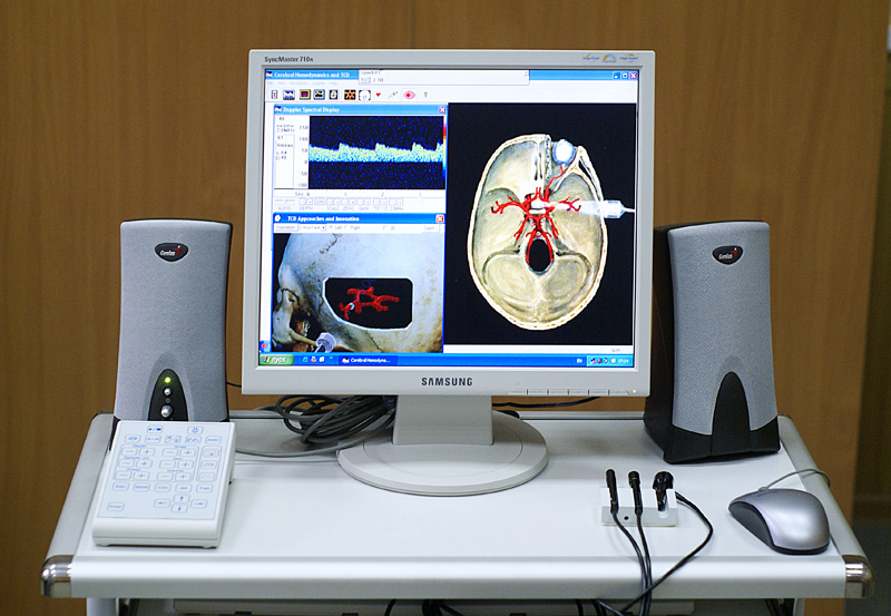 Doppler transcrânien