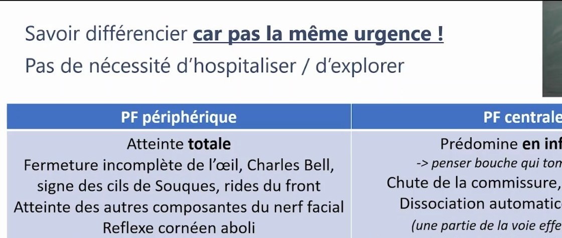 Altération Aiguë de la Vision