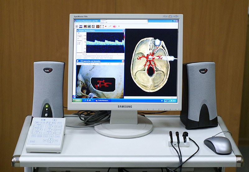 Doppler transcrânien