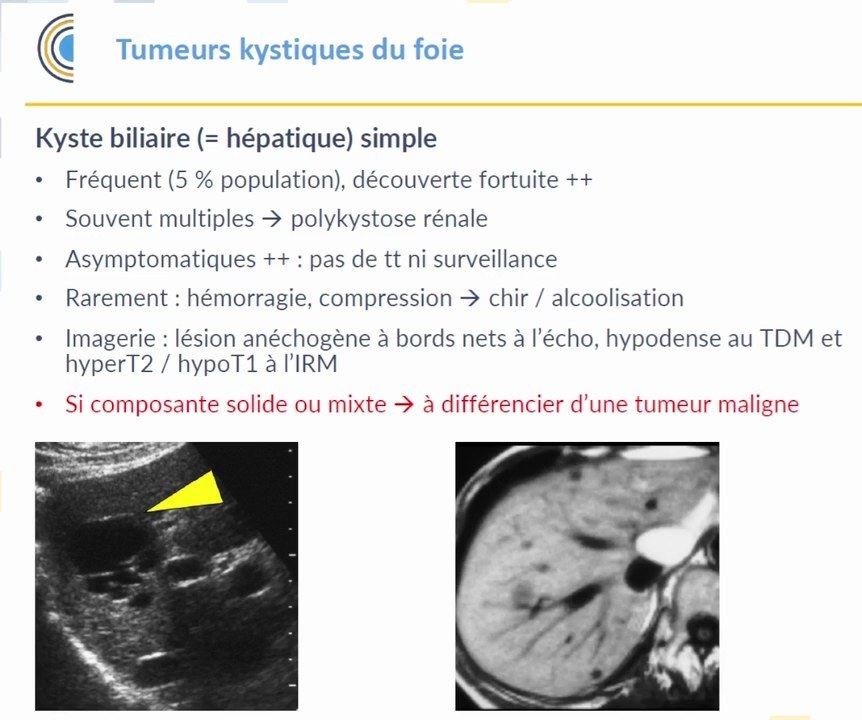 Tumeurs du Foie Primitives et Secondaires