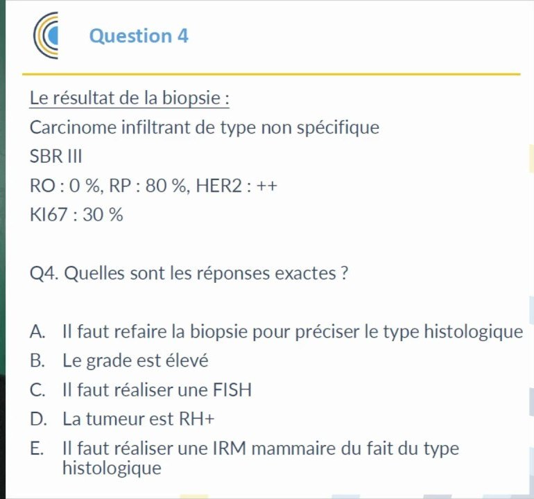 Tumeurs du Sein