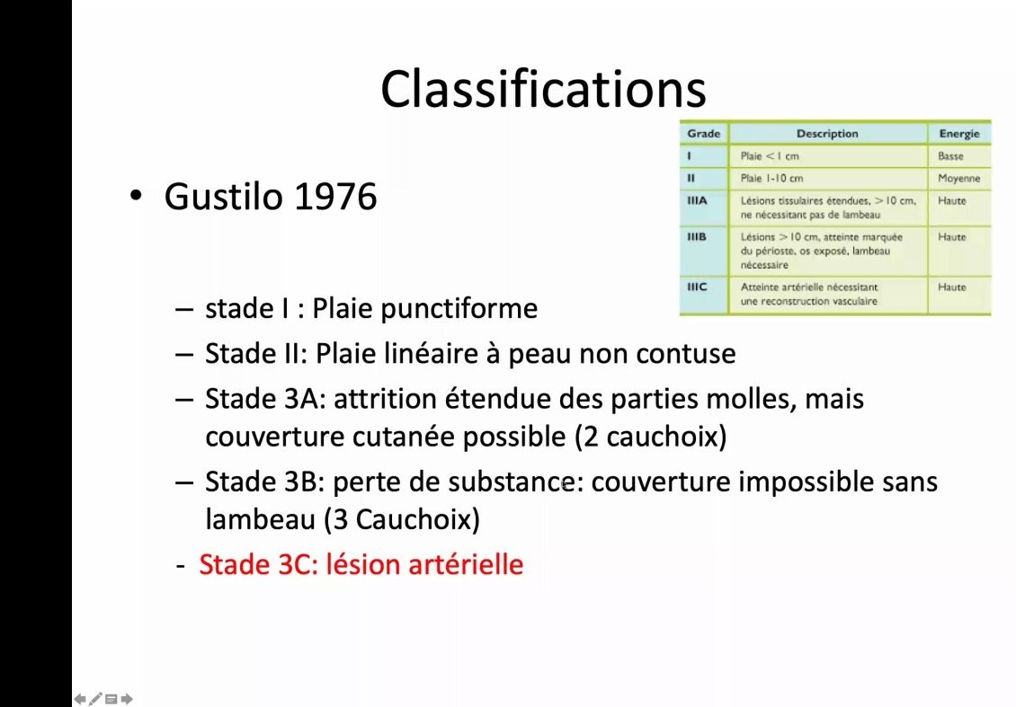 Classification de Gustilo des fractures ouvertes
