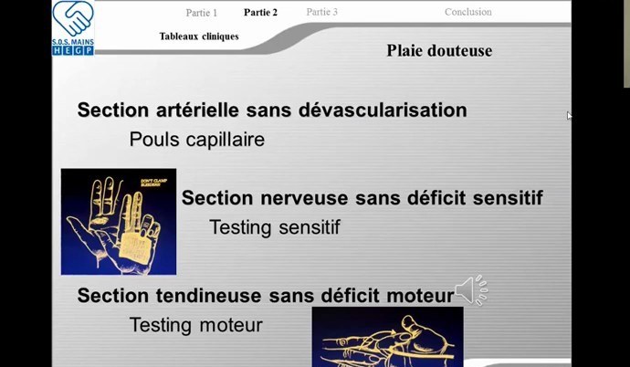 Plaie douteuse de la main avec tests vasculaire, nerveux et tendineux