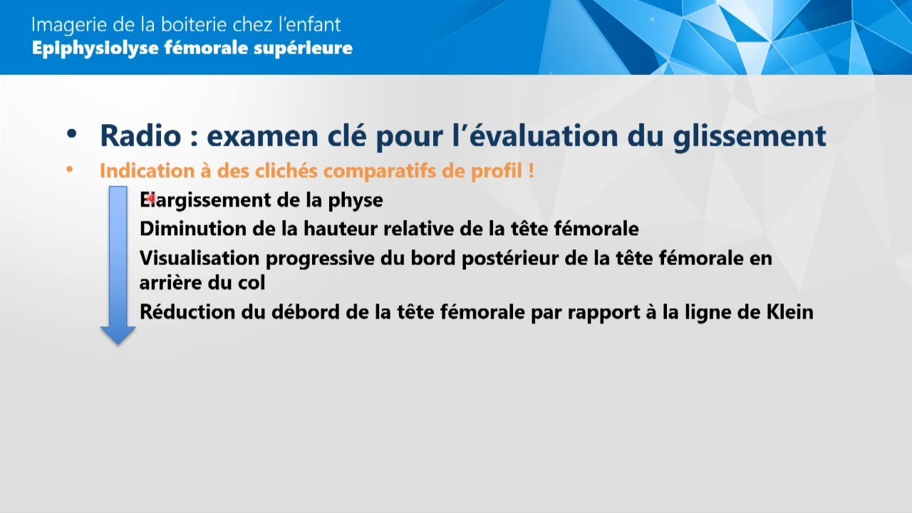 Épiphysiolyse fémorale supérieure avec critères radiographiques