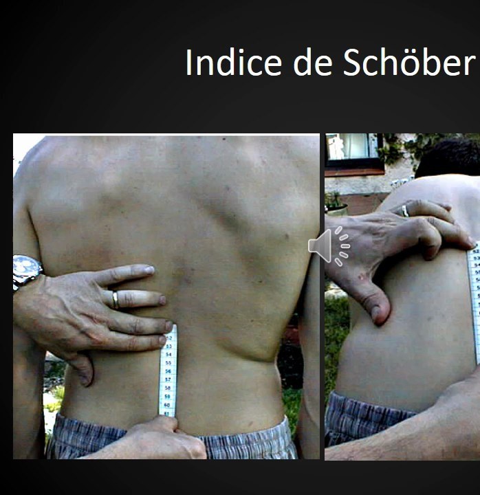 Indice de Schober pour mobilité lombaire