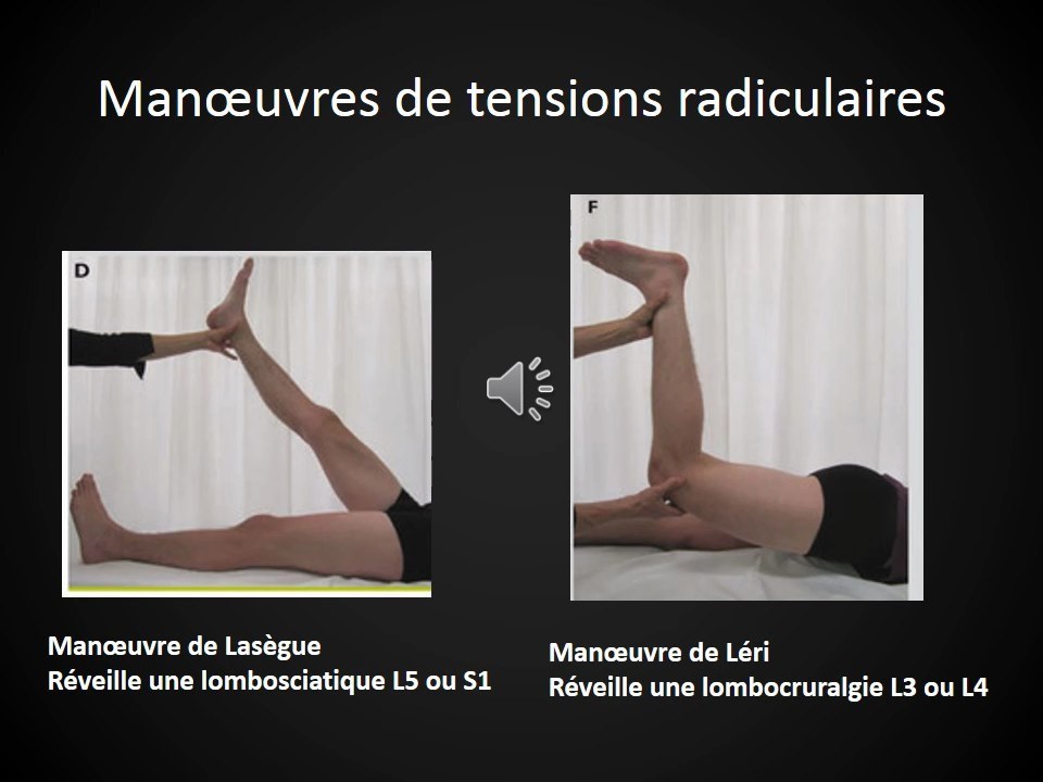 Manoeuvres de Lasègue et Léri