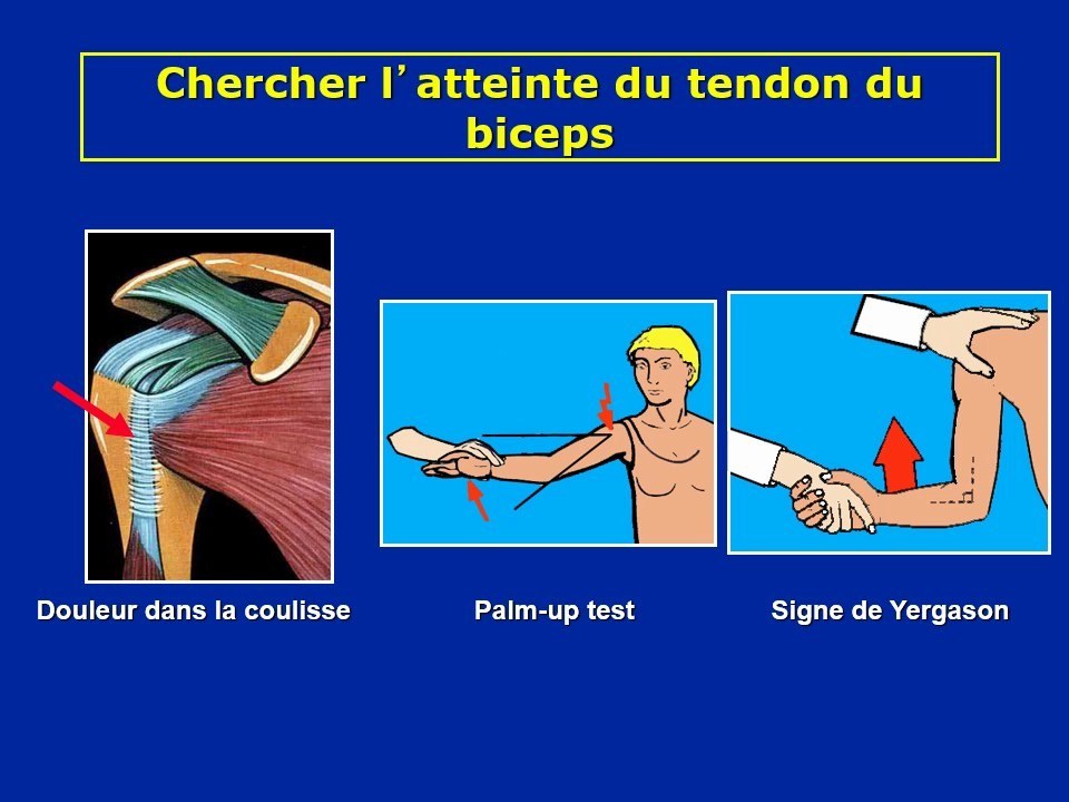 Tests du tendon du biceps à l'épaule