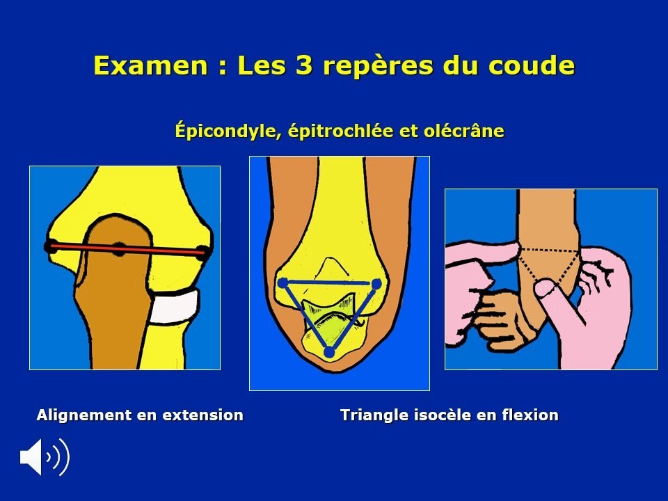 Trois repères du coude en extension et flexion