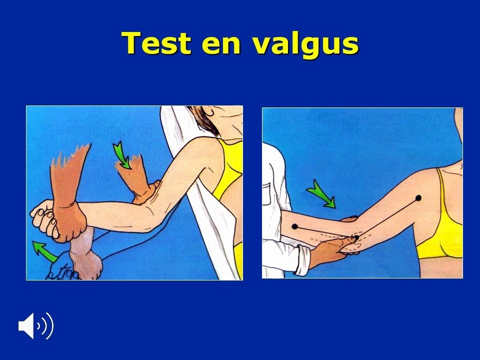 Test en valgus du coude