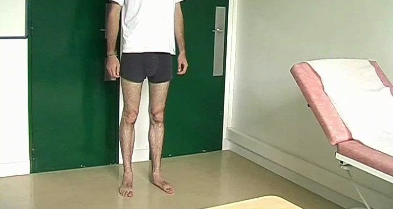 Inspection debout de la hanche et des membres inférieurs