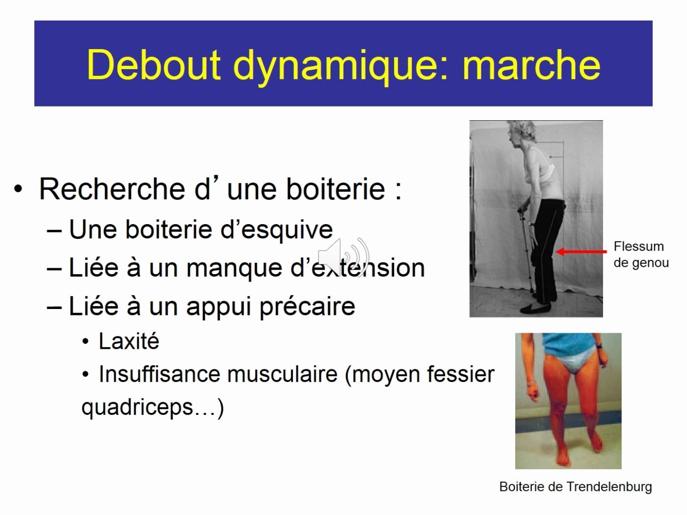 Examen dynamique du genou à la marche