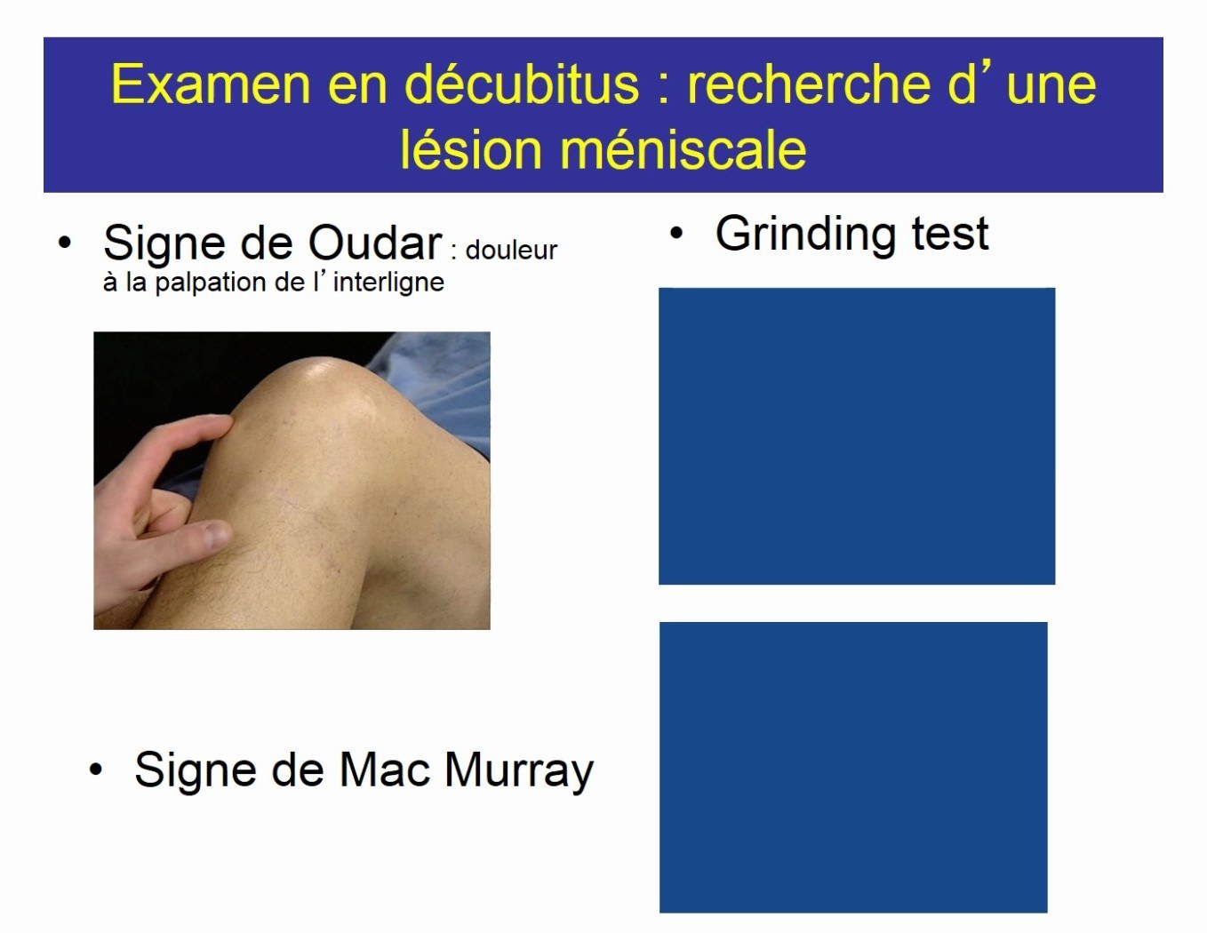 Tests méniscaux et examen en décubitus du genou