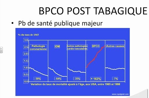 Sémiologie Pneumologique et Examen Respiratoire