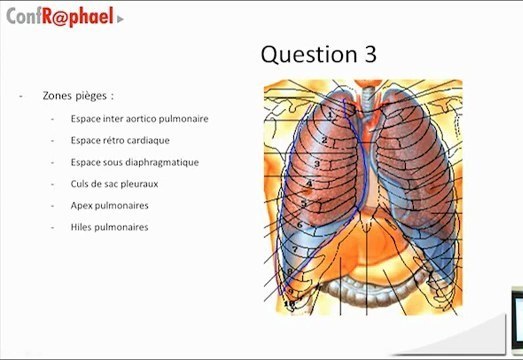 Question de repères anatomiques