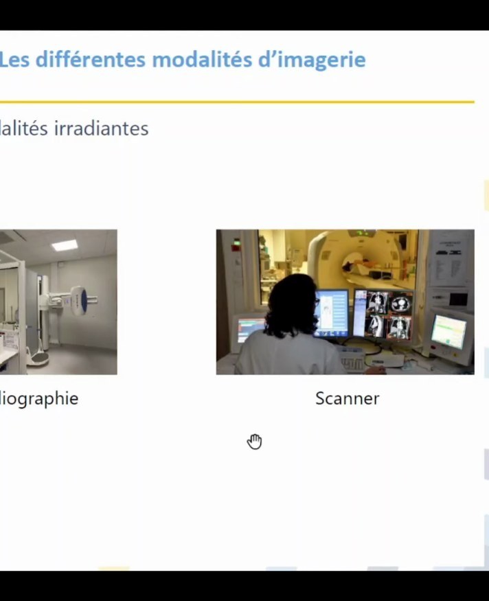 Modalités d'imagerie et place du scanner